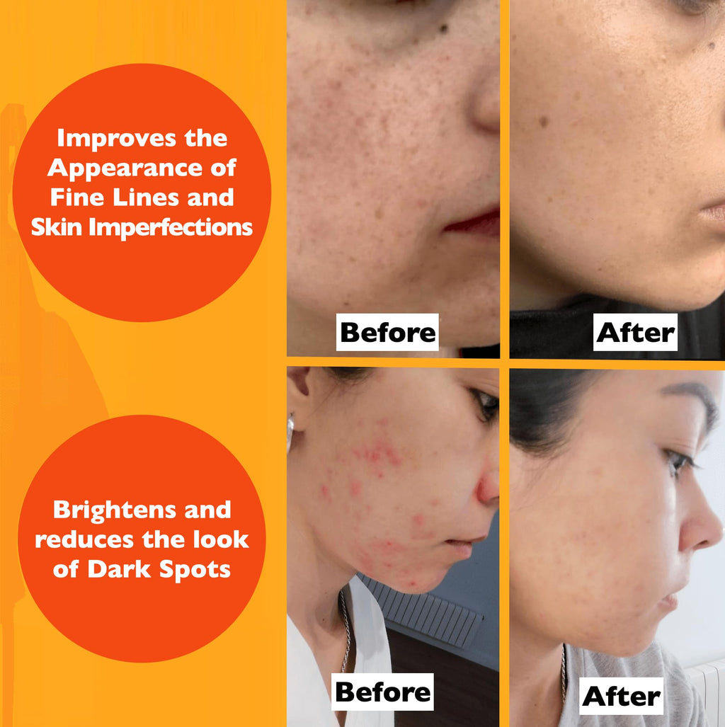 Vitamin C Serum For Face – Anti-Aging Facial Serum with Vitamin C, Hyaluronic Acid, Niacinamide, B5 & Vit E. Brightening Facial Essence for Dark Spots, Fine Lines, Wrinkles & Glowing Skin, 2 Fl Oz