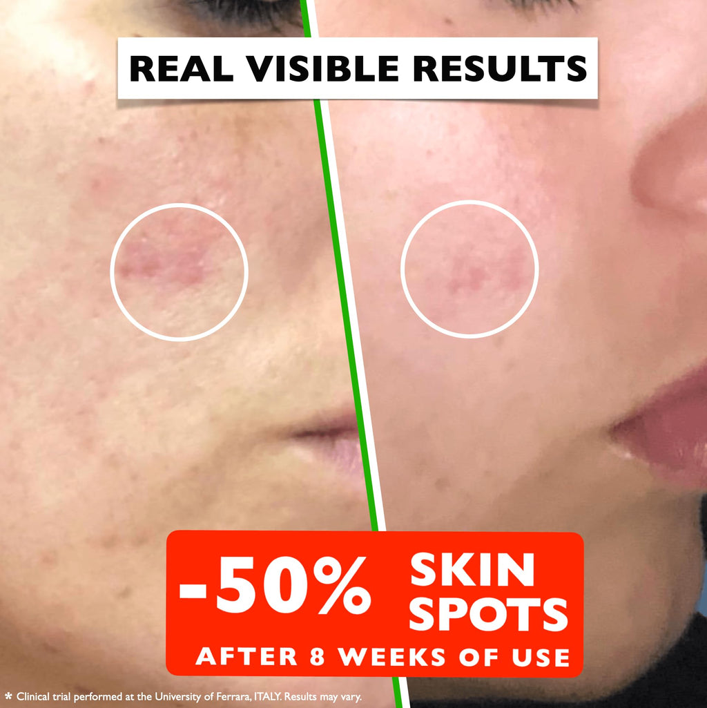 Vitamin C Serum For Face – Anti-Aging Facial Serum with Vitamin C, Hyaluronic Acid, Niacinamide, B5 & Vit E. Brightening Facial Essence for Dark Spots, Fine Lines, Wrinkles & Glowing Skin, 2 Fl Oz