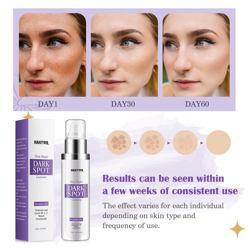 HANYWIL Dark Spot Remover for Face & Body Serum,Rapid Tone Repair Cream with Hyperpigmentation Treatment,Sun Spot, Age Spot & Melasma Remover,Dermatologist-Tested Brightening Retinol Serum (1.7 Fl Oz)